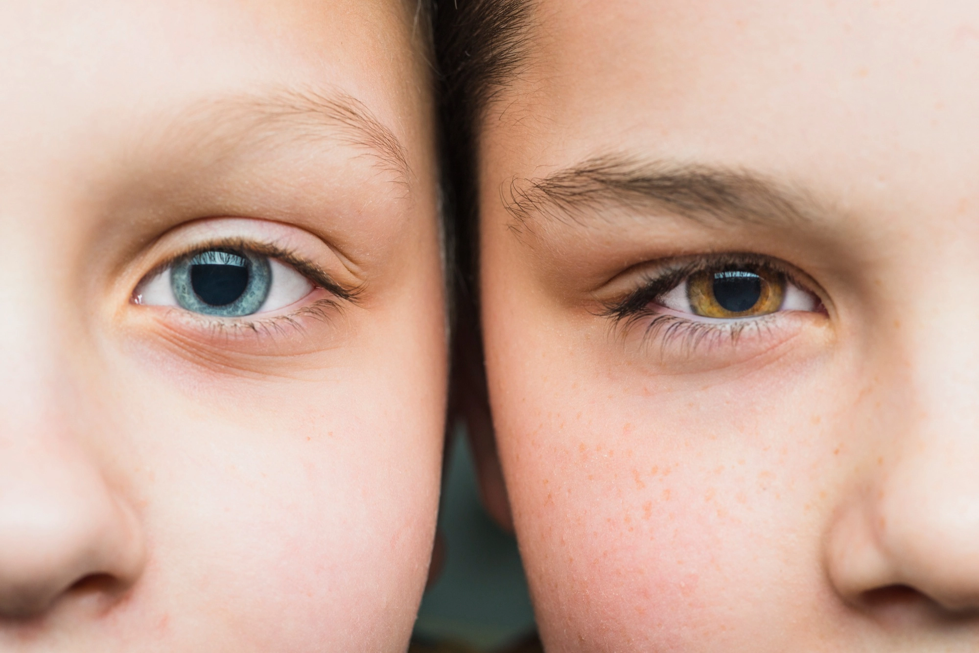 Dr. Shipra Gupta - Eye Surgeon Agra