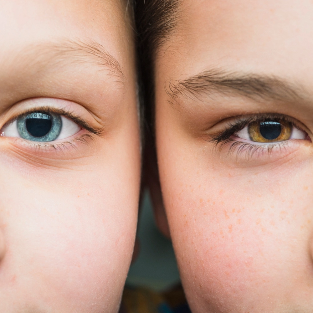 Glaucoma Diagnosis & Management